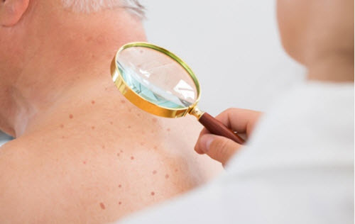 gw-8-21-18-skin-protection